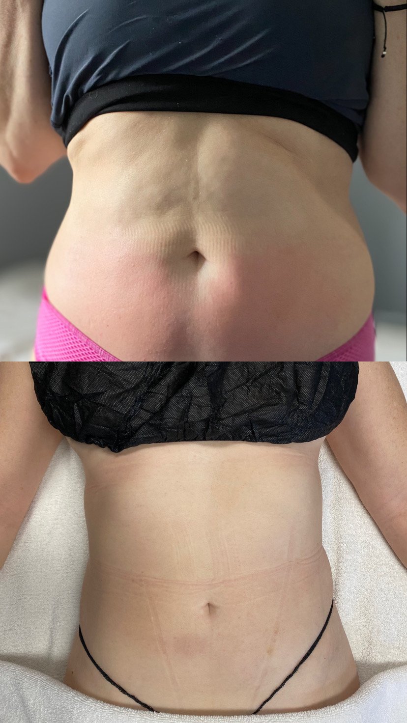 These photos showcase real results from current patients at Bella Viva Center.