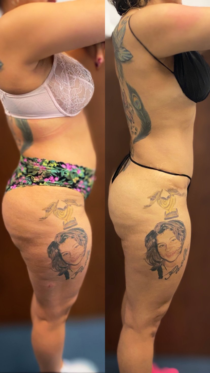 These photos showcase real results from current patients at Bella Viva Center.