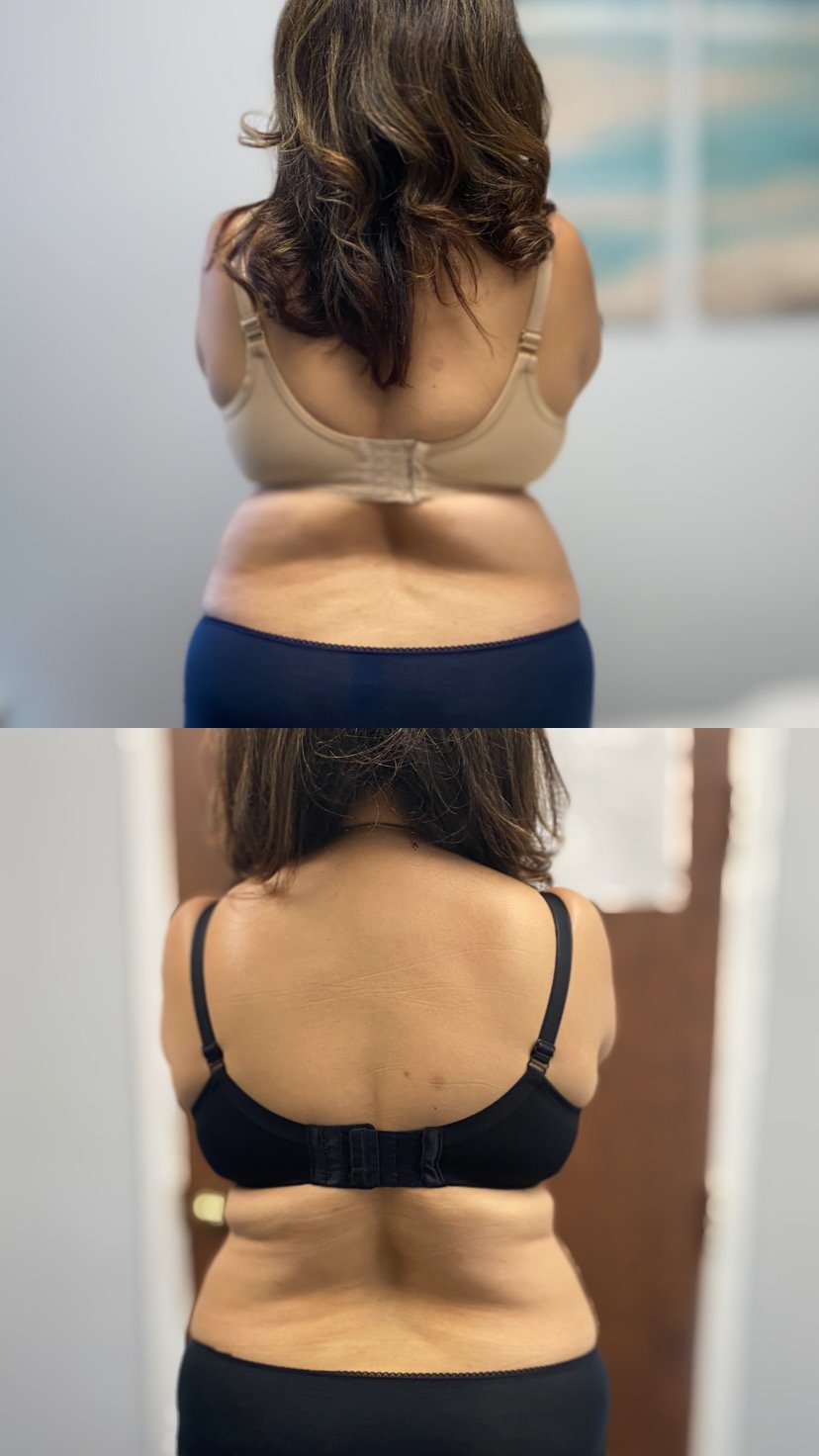 These photos showcase real results from current patients at Bella Viva Center.