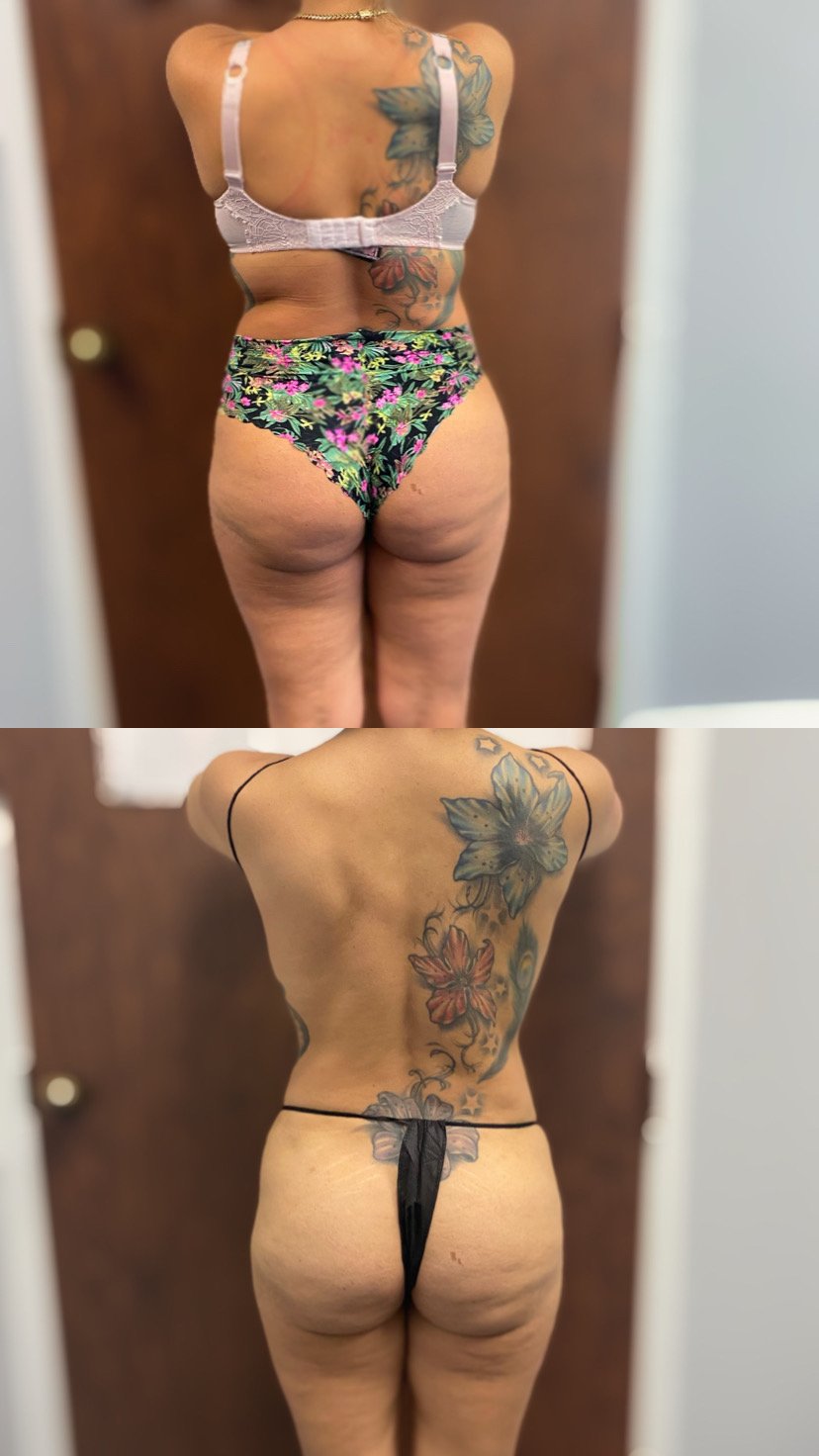 These photos showcase real results from current patients at Bella Viva Center.