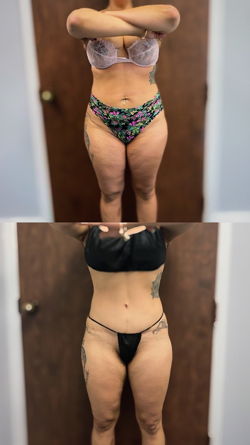 These photos showcase real results from current patients at Bella Viva Center.