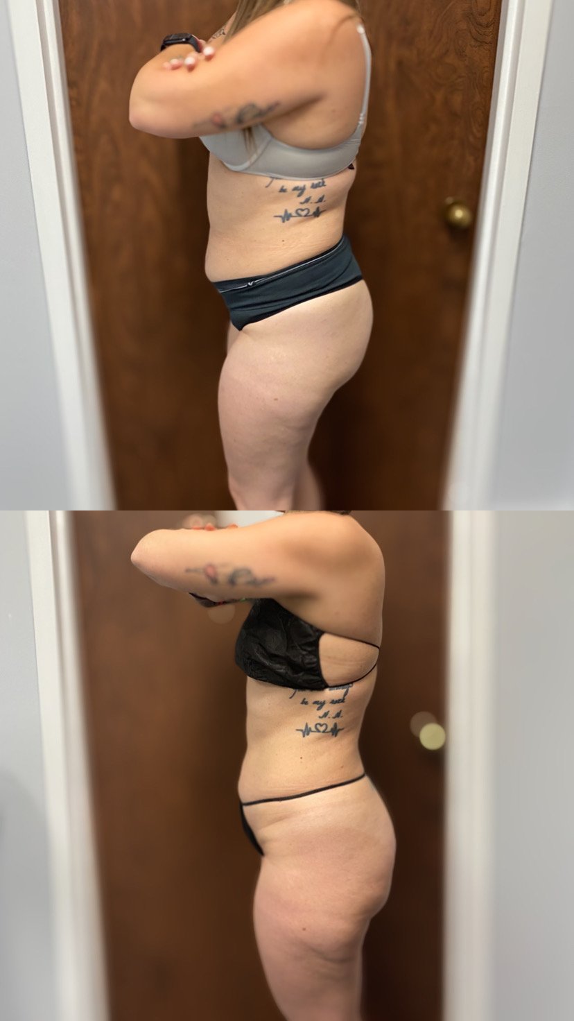 These photos showcase real results from current patients at Bella Viva Center.